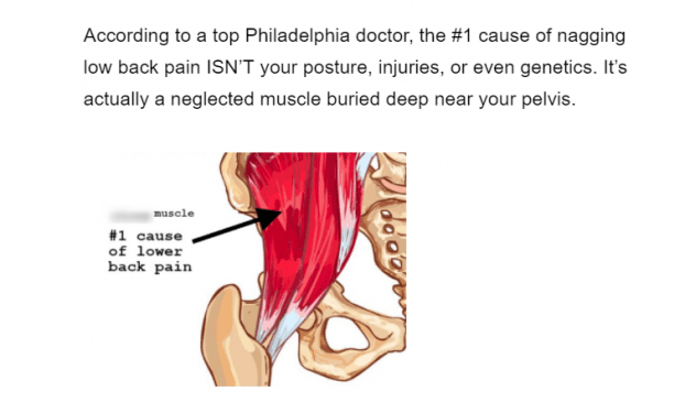 Cause of Backpain